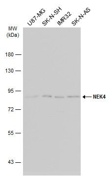 NIMA related kinase 4 Antibody