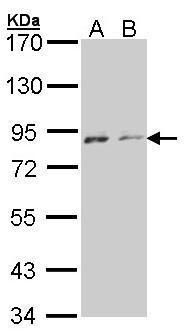 NIMA related kinase 4 Antibody