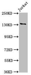NPHS1 Antibody
