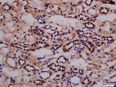 Phospho-Nephrin (Tyr1217) Rabbit Polyclonal Antibody