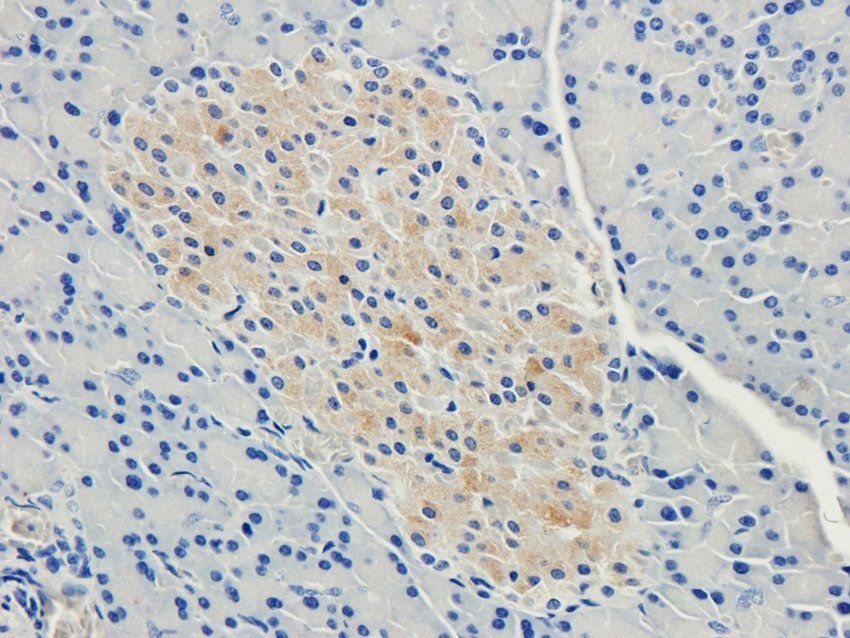 Nesprin 1 Rabbit Polyclonal Antibody