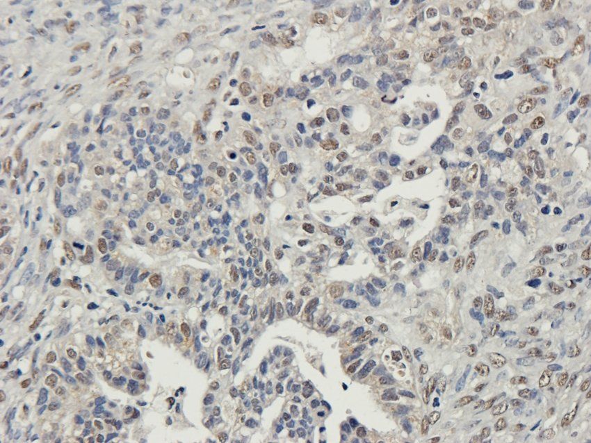 Nesprin 1 Rabbit Polyclonal Antibody