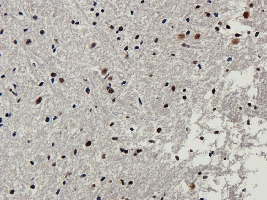 Nesprin 1 Rabbit Polyclonal Antibody