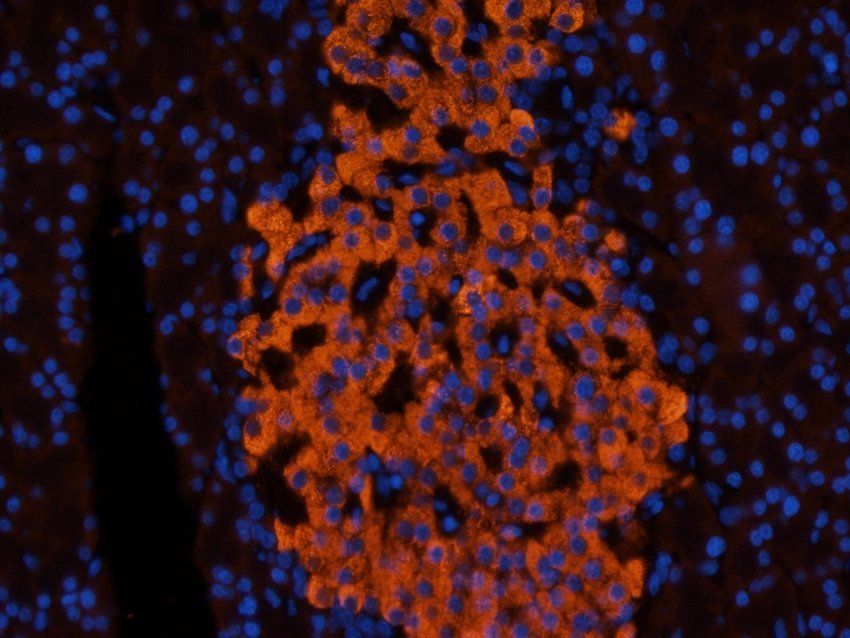 Nesprin 1 Rabbit Polyclonal Antibody