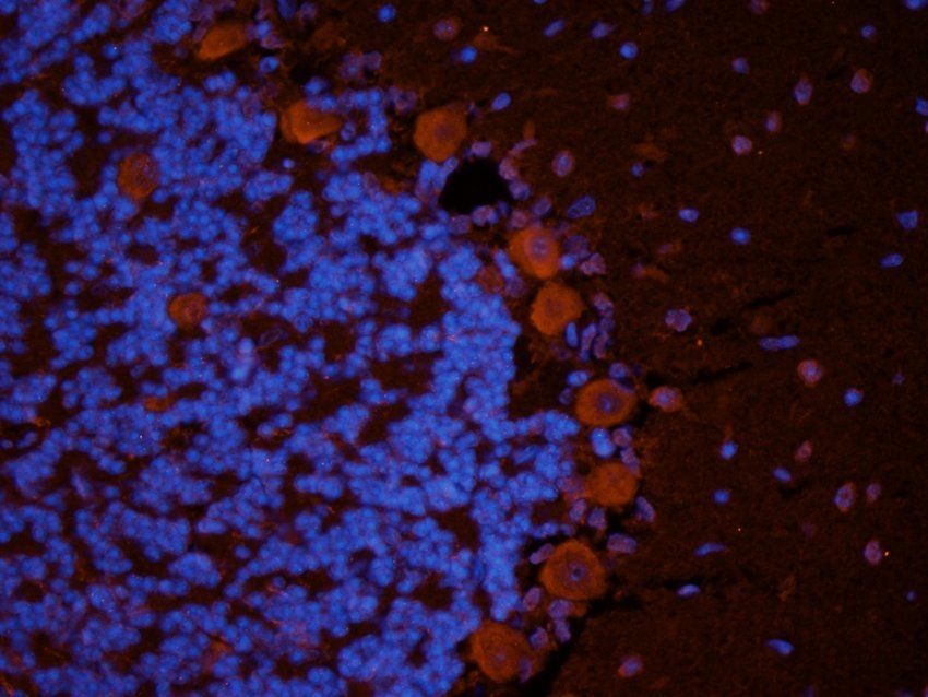 Nesprin 1 Rabbit Polyclonal Antibody