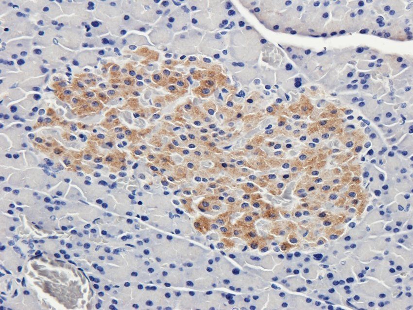 Nesprin 1 Rabbit Polyclonal Antibody