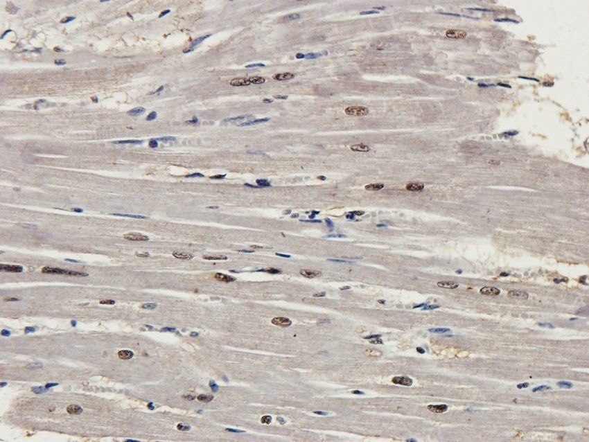 Nesprin 1 Rabbit Polyclonal Antibody