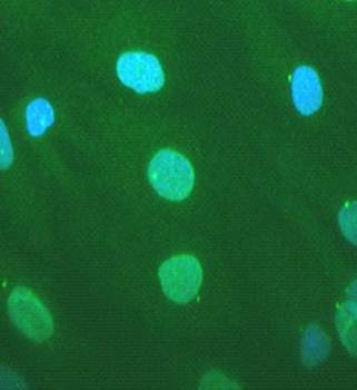 Nesprin 1 Monoclonal Antibody