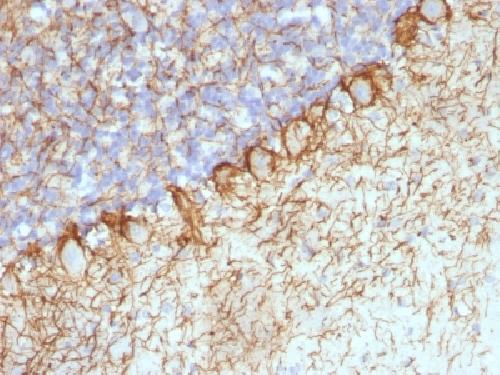 NEFH Antibody