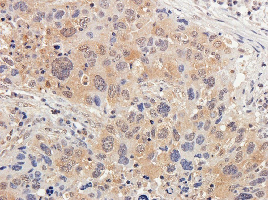 Neuroplastin Rabbit Polyclonal Antibody