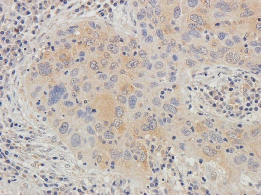 Neuroplastin Rabbit Polyclonal Antibody