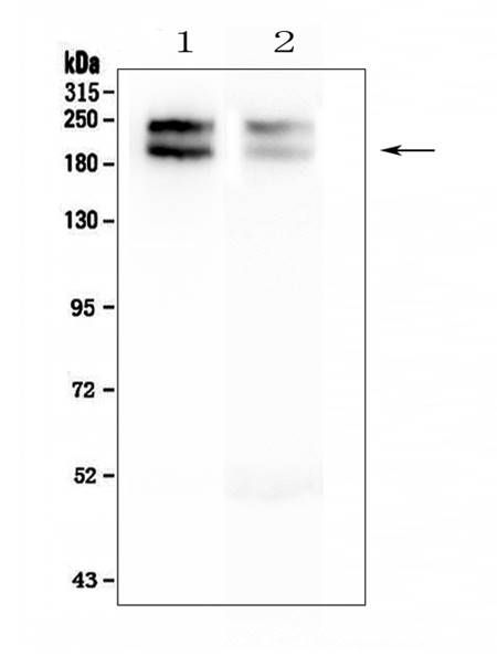 NEFH Mouse Monoclonal Antibody