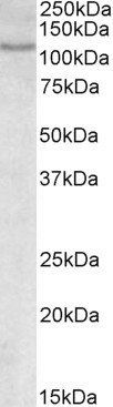 NFATC2/NFAT1 Antibody