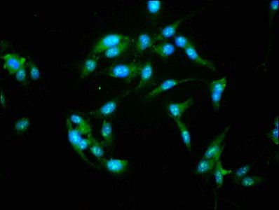 NFATC3 Antibody