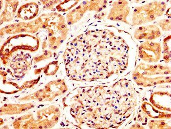 NFATC3 Antibody