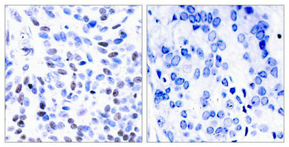 NFKB2 Antibody