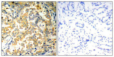 NFKB2 Antibody