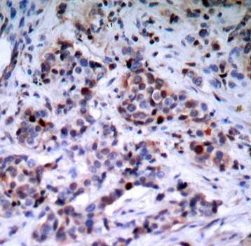 NFκB-p65(Phospho-Thr435) Antibody