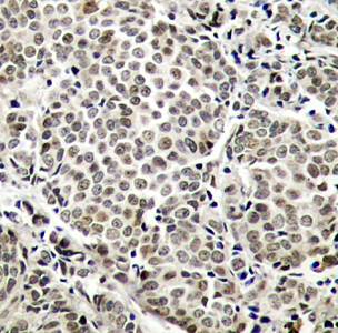 NFκB-p65 (Phospho-Ser529) Antibody