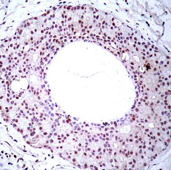 NFκB-p65 (Phospho-Thr254) Antibody