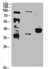 NFKBIA Antibody