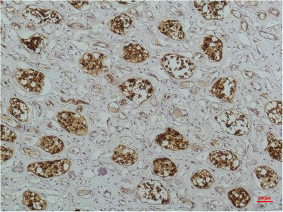 NFKBIB Antibody