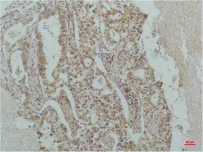 NFKBIB Antibody