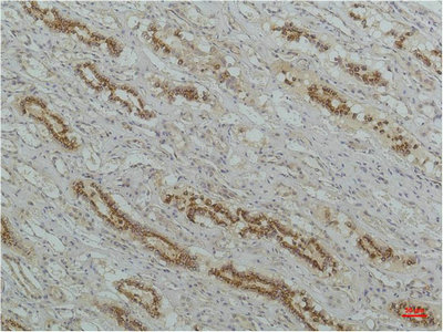 NFKBIB Antibody
