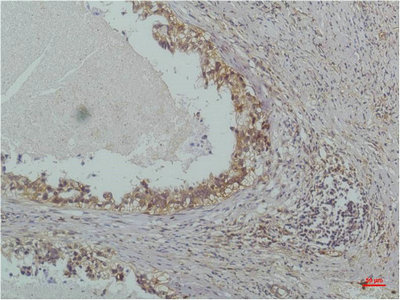 NFKBIB Antibody