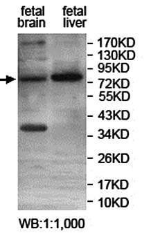NFKBIZ Rabbit Polyclonal Antibody