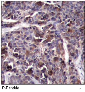 NFκB-p65 (Phospho-Thr505) Antibody