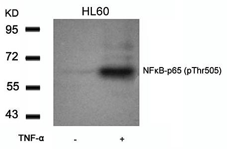 NFκB-p65 (Phospho-Thr505) Antibody