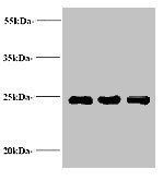 LCN2 Antibody