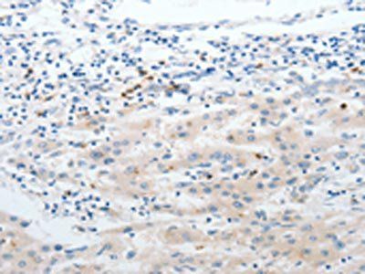LCN2 Antibody