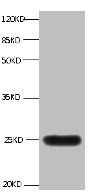 LCN2 Antibody