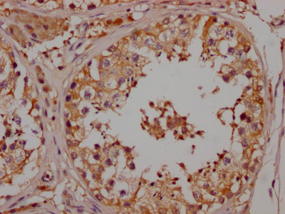 NGF Antibody