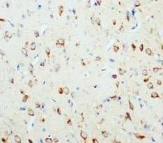 Beta-nerve growth factor NGF Rabbit Polyclonal Antibody