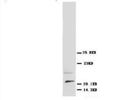Beta-nerve growth factor NGF Rabbit Polyclonal Antibody