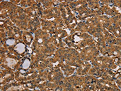 BEX3 Antibody