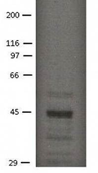 SLC9A3R2 Monoclonal Antibody
