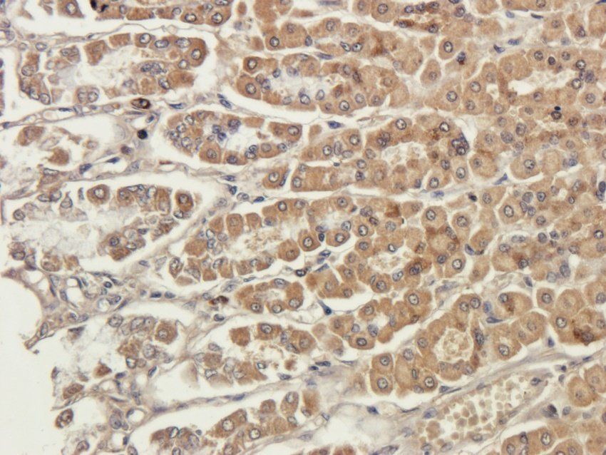 NINJ1 Rabbit Polyclonal Antibody