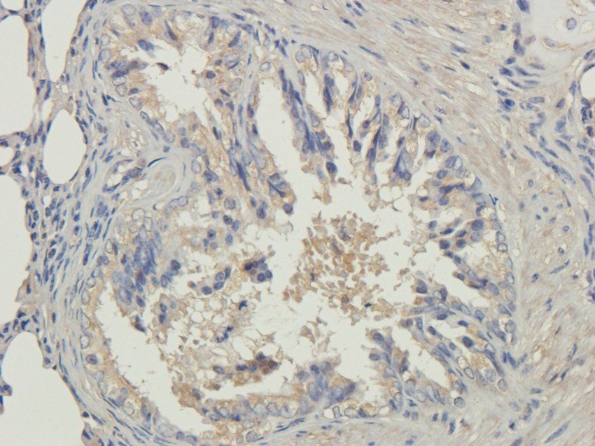 NINJ1 Rabbit Polyclonal Antibody