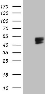 NIPP1 Antibody