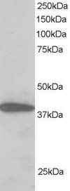 NIPP1/PPP1R8 Antibody