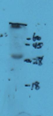 NCR2 Rabbit Polyclonal Antibody