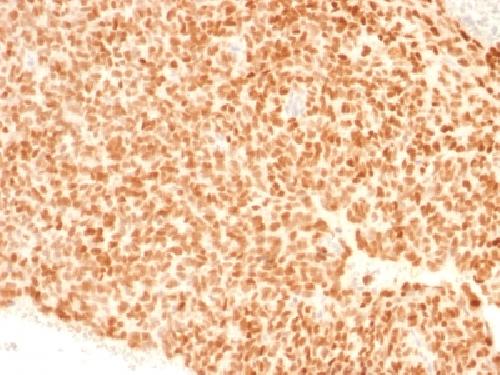 NKX2-2 Antibody