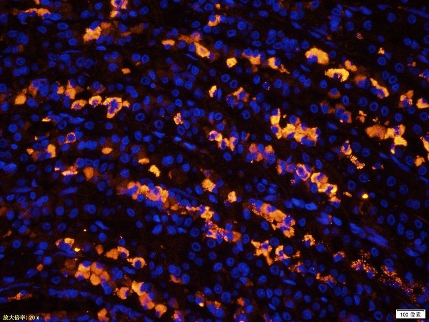 NKX2-5 Rabbit Polyclonal Antibody
