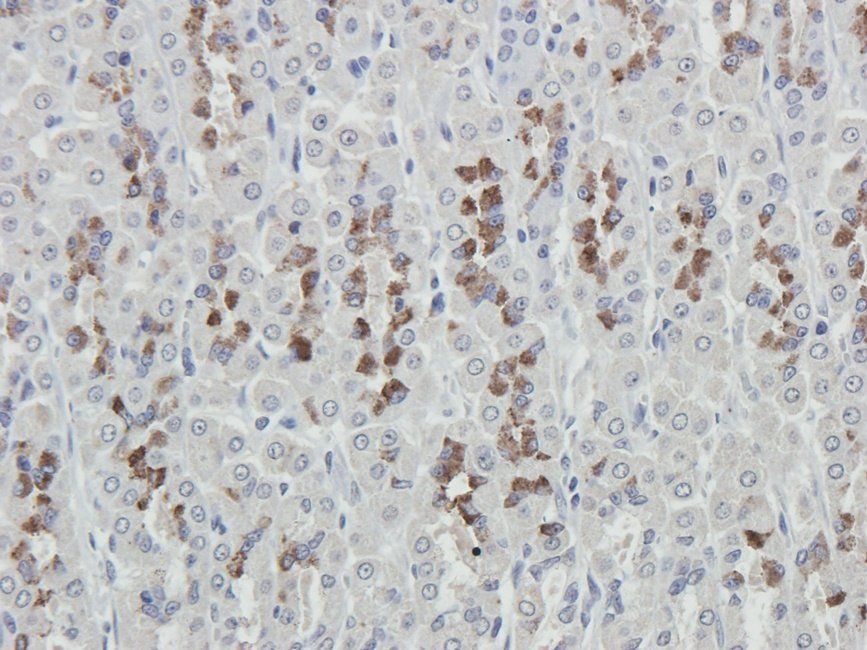 NKX2-5 Rabbit Polyclonal Antibody