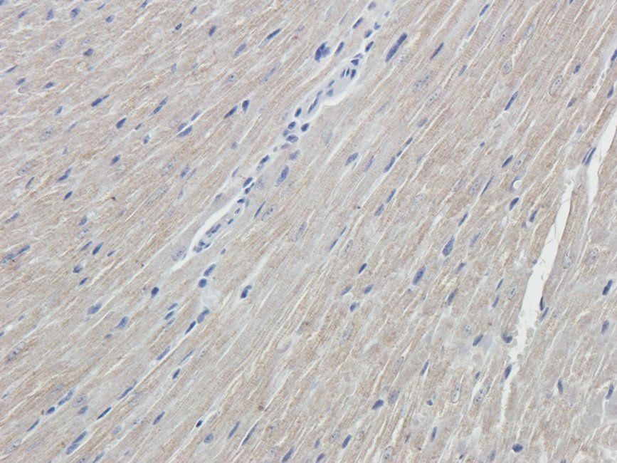 NKX2-5 Rabbit Polyclonal Antibody
