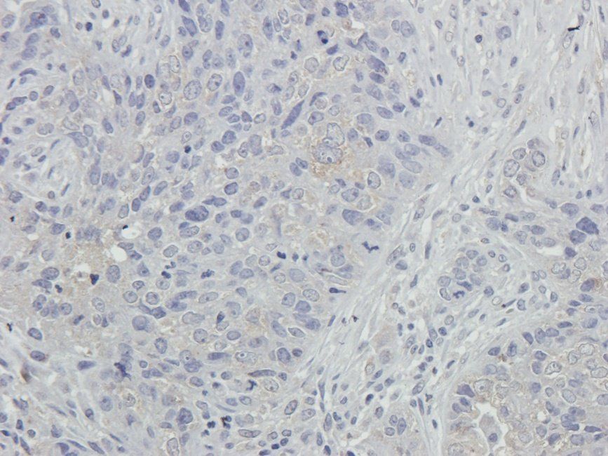 NKX2-5 Rabbit Polyclonal Antibody